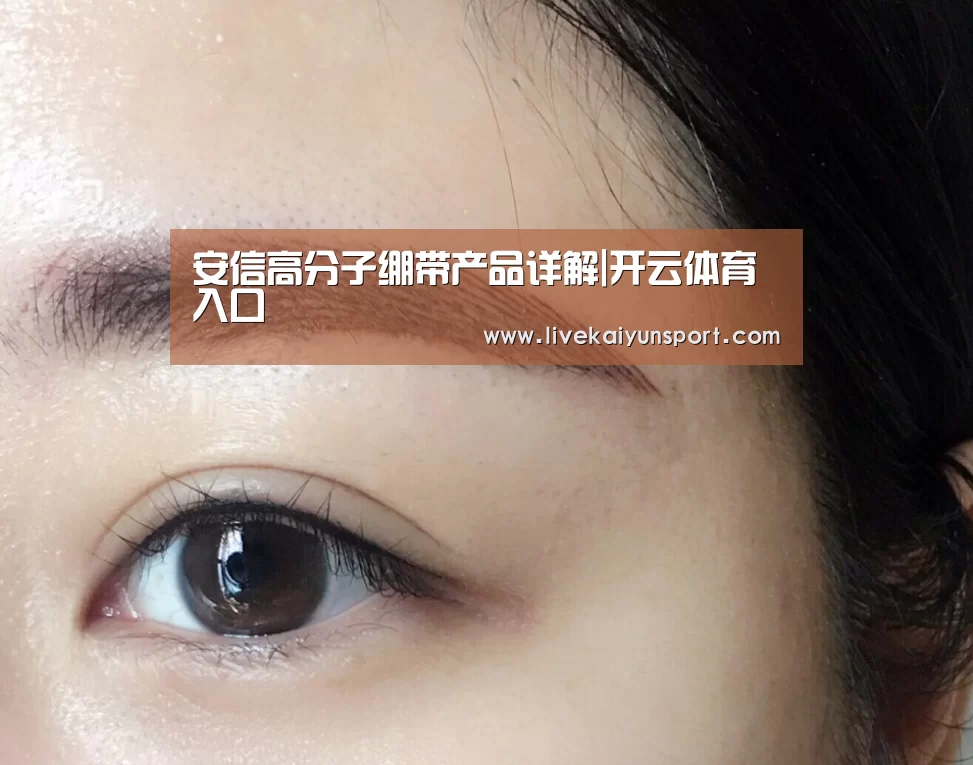 安信高分子绷带产品详解|开云体育入口(图3) 开云体育高清直播